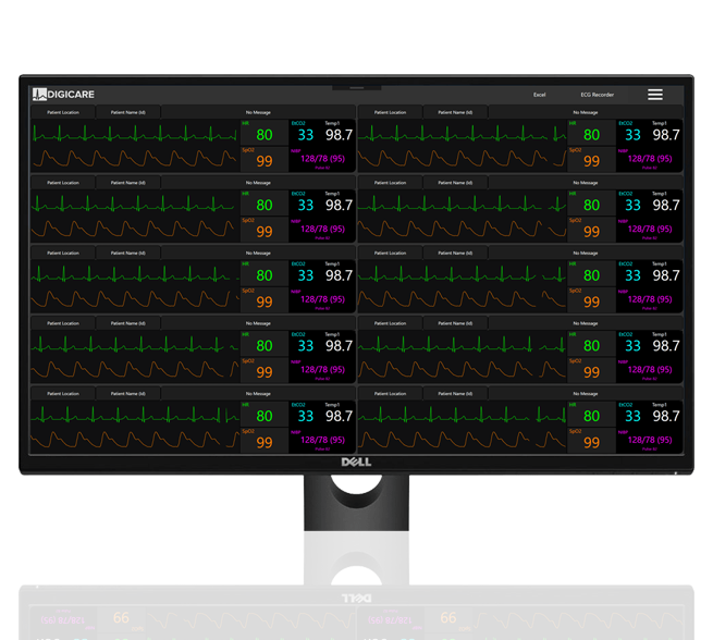 Along with Better Patient Care, Dividends Can Accrue with Purchase of Central Monitoring System