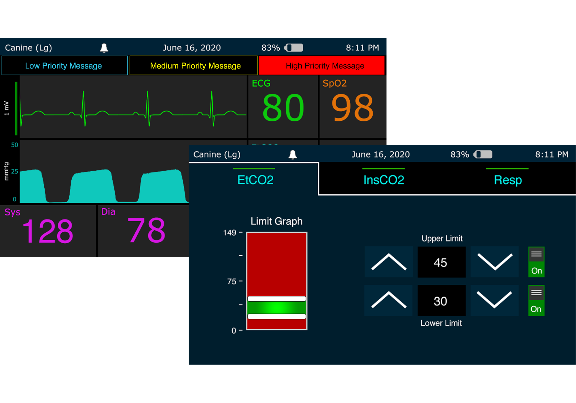 ECG Settings