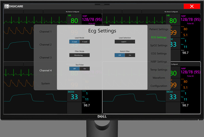 ECG Settings