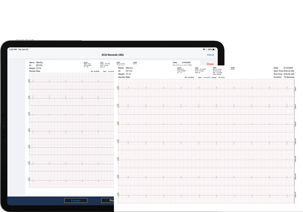 ECG Settings